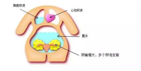 每个月卵泡有几个，探究女性生殖系统的奥秘